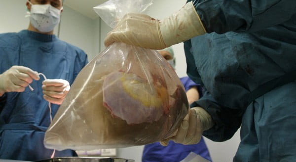 7 israéliens inculpés pour trafic d'organe