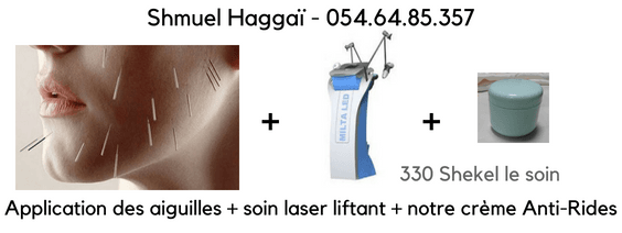 Lifting acupuntural Shmuel Haggai 
