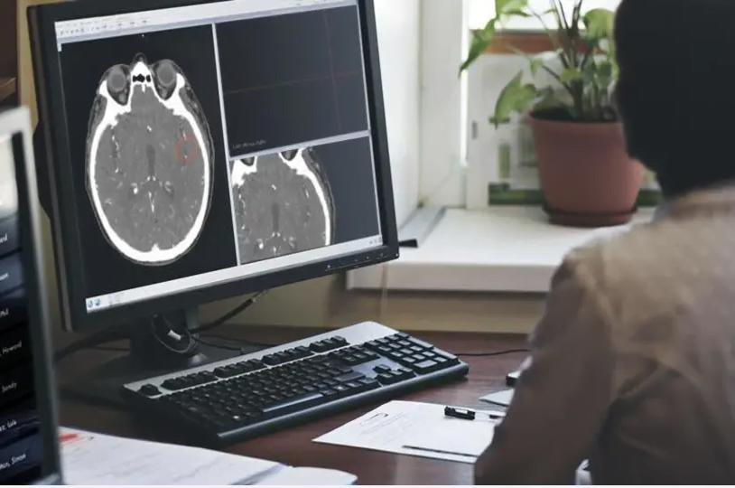 volume de l'amygdale