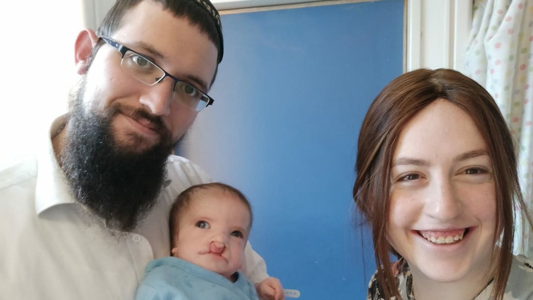 En Israël elle donne naissance à un bébé avec des multi malformations mais a décidé de le rendre le beau du monde