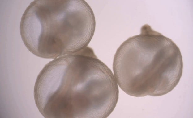 Recherche scientifique israélienne : des foetus se développent en dehors de l'utérus