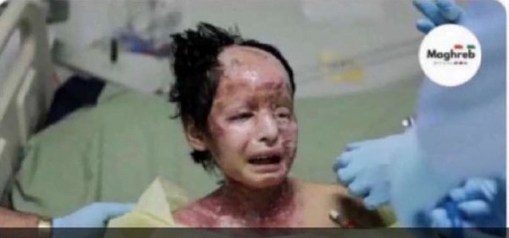 Gare à cette photo détournée accusant Israël d'utiliser du phosphore blanc.