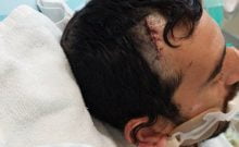 Attaque terroriste à Elad : Une des victimes est sorti du coma