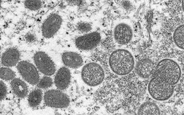Troisième cas de la variole du singe en Israël, faut-il s'inquiéter ?