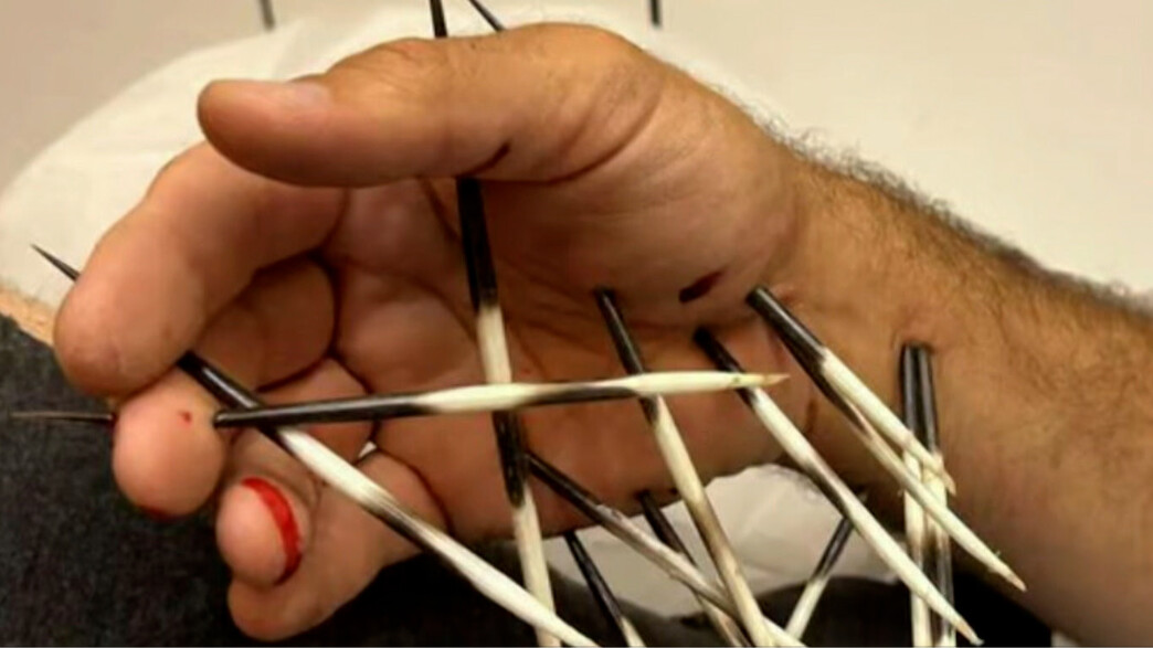 Crocodile, porc épique, rats : Une Intifada Sauvage Qui Fait Presque Oublier les Vrais Ennemis