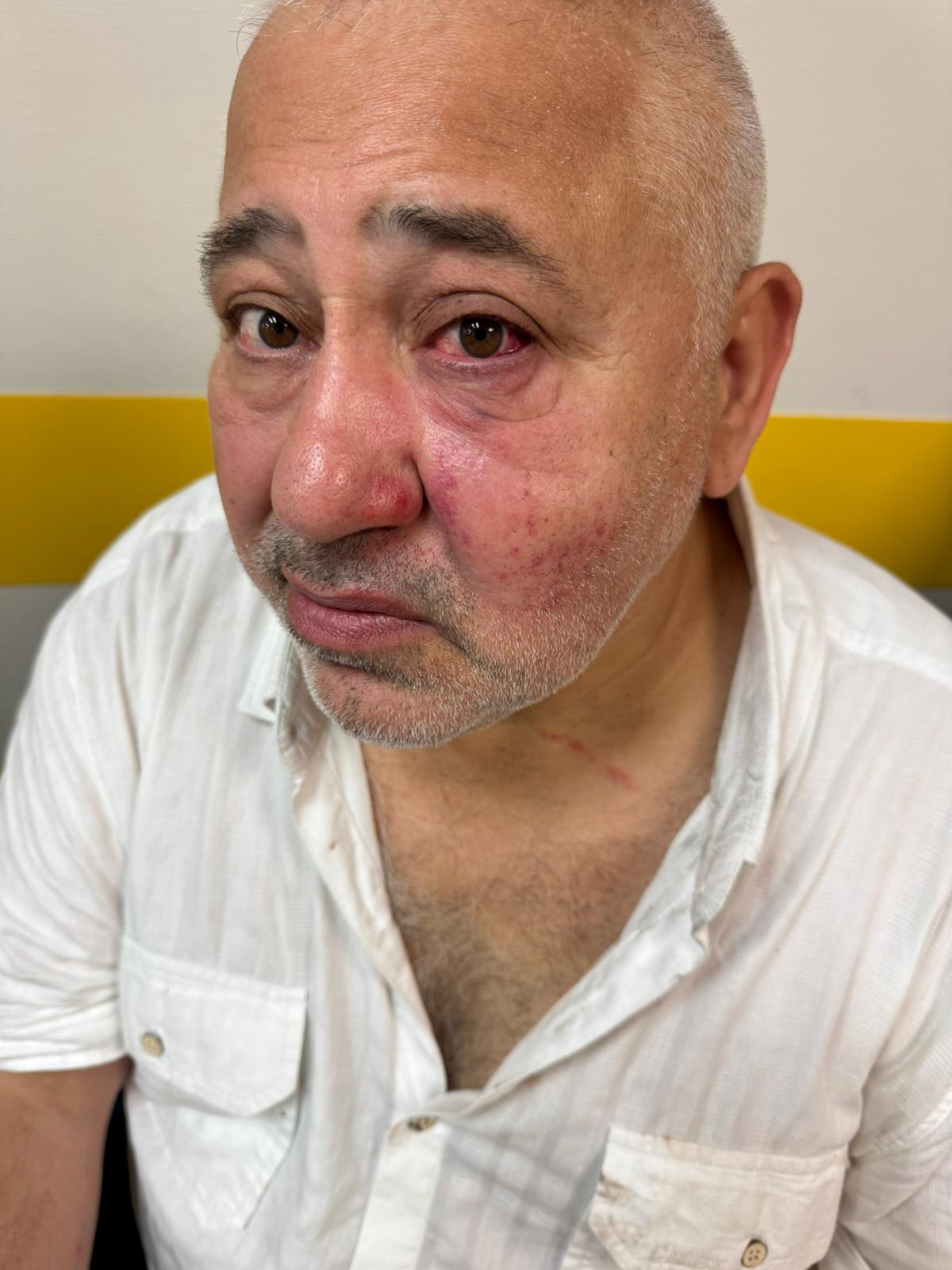 Antisémitisme : 3 Arabes frappent un Juif à Pavillons-sous-Bois et lui arrachent son étoile de David