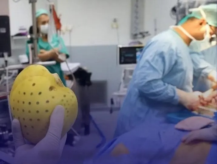 Un cœur artificiel implanté en Israël, puis remplacé par un vrai : une révolution médicale