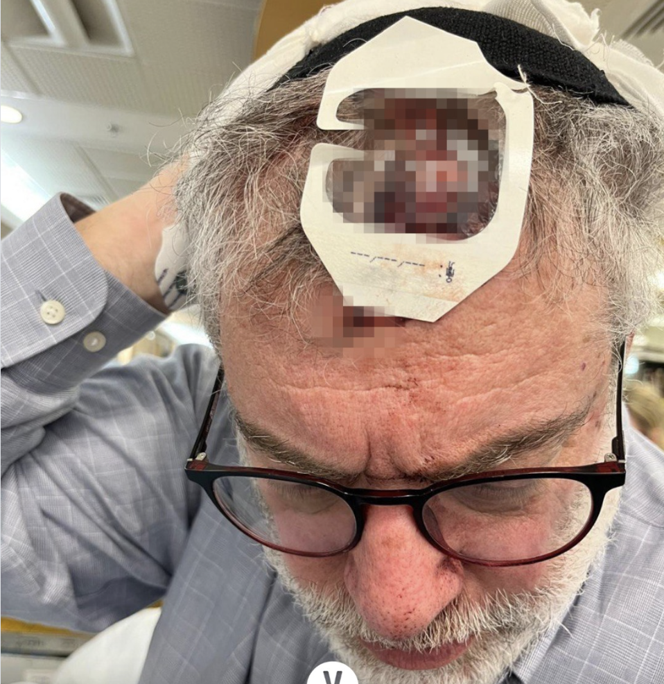 chutes dans les bus Israël, bus électriques Israël, accidents transports publics Israël, sécurité des bus Israël, hospitalisations bus Israël, freinage brutal bus, passagers blessés bus, transport public danger Israël, personnes âgées transports Israël, Ynet accidents bus