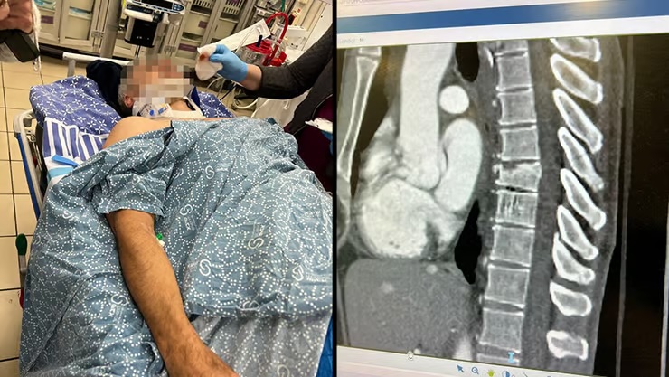 Cycliste brisé à Ramat Gan : 10 000 shekels de récompense pour retrouver les adolescents agresseurs
