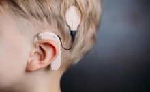 La Clalit réclame près de 15 millions de shekels pour des implants cochléaires défectueux