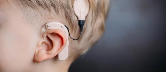 La Clalit réclame près de 15 millions de shekels pour des implants cochléaires défectueux