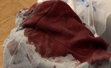 Tel-Aviv : mon fils de 15 ans poignardé 9 fois dans un jardin public, l'État a rendu nos rues aux gangs