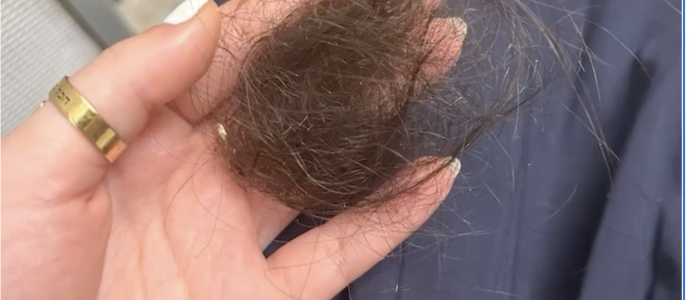 Agression antisémite dans le métro de New York : étranglée, frappée, ses cheveux arrachés -vidéo