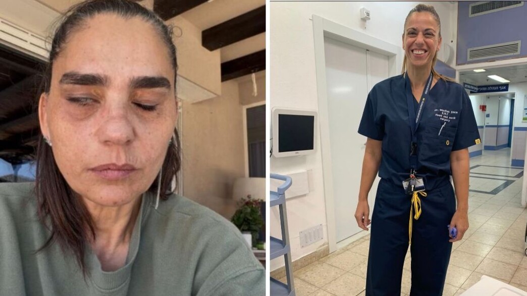 La médecin que des centaines d'Israéliens appellent au secours quand leur visage se paralyse