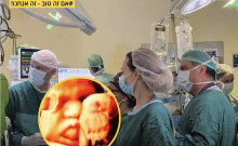 Quand l'audace médicale israélienne sauve un fœtus chypriote de l'asphyxie
