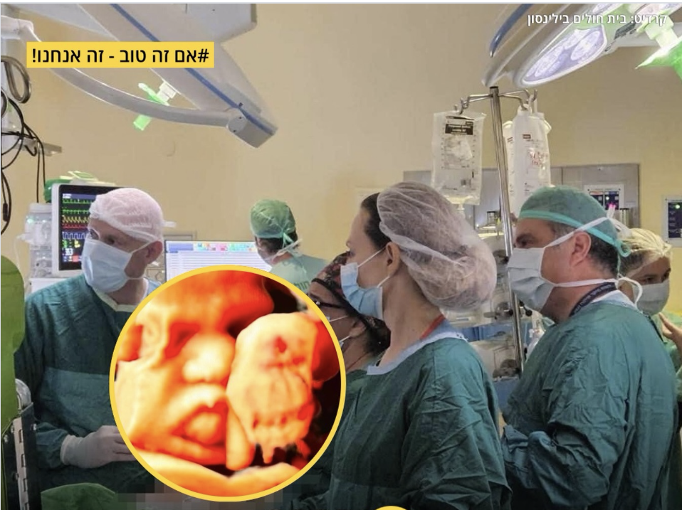Quand l'audace médicale israélienne sauve un fœtus chypriote de l'asphyxie