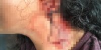 Beit Shemesh : une adolescente de 16 ans tabassée dans un bus pour un sac posé sur un siège