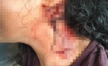 Beit Shemesh : une adolescente de 16 ans tabassée dans un bus pour un sac posé sur un siège