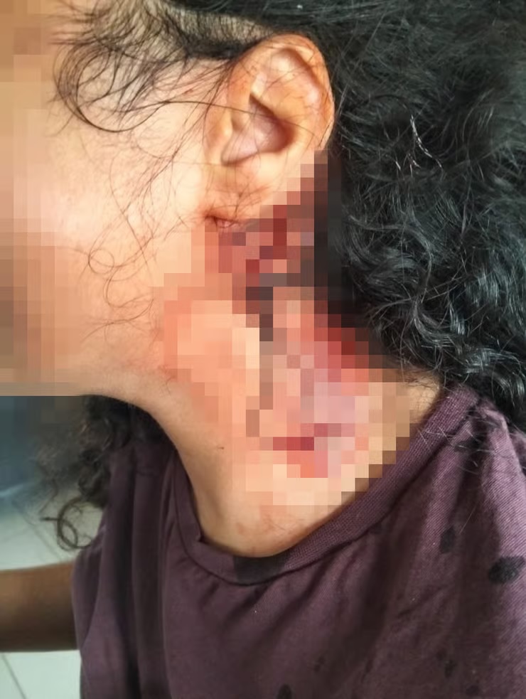 Beit Shemesh : une adolescente de 16 ans tabassée dans un bus pour un sac posé sur un siège
