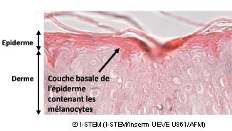 Sciences: Redonner couleur à la peau, grâce aux cellules souches