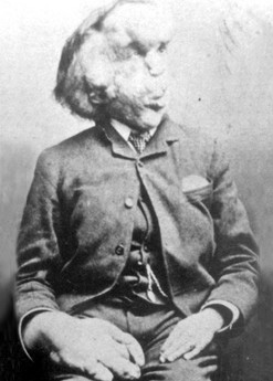 elephantman1.jpg